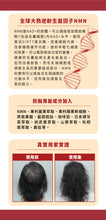 將圖片載入圖庫檢視器 WholeLove Hair 愛完全 活髮系列全爆髮 NMN 防脫育髮精華素 100毫升